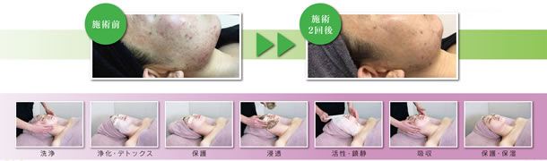 グレッセンのエルモサハーブ