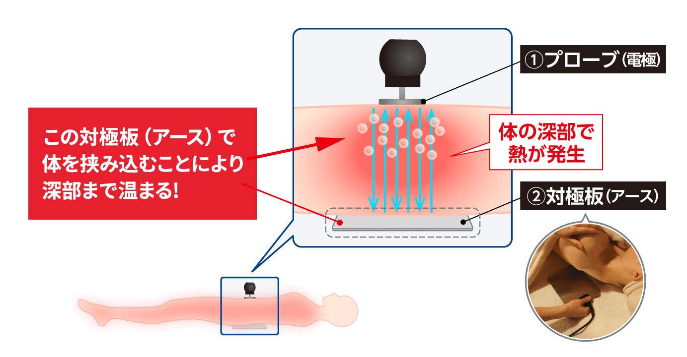 加古川市のグレッセン、フェイシャルメニュー